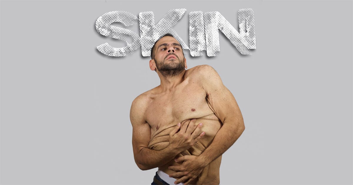 Short Film Review Skin Is A Sensitive Telling Of Body Image Issue